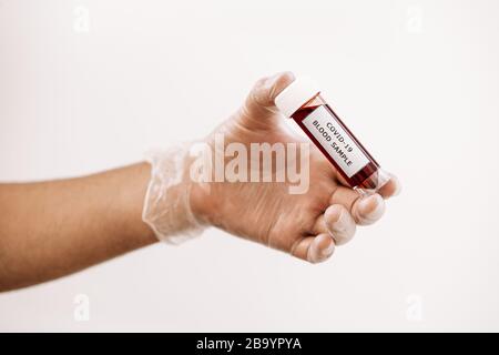 Hand mit Handschuh, der eine mit Kovid 19 infizierte Durchstechflasche mit Blutprobe, medizinisches Konzept und Schutz vor Viren und Bakterien nimmt Stockfoto