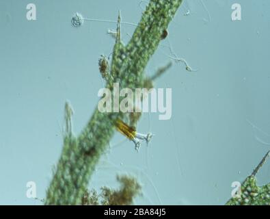 Rotationstiere unter dem Mikroskop in einem Tropfen Wasser 100x Stockfoto