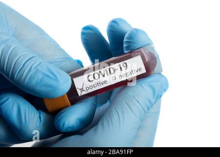 Bluttestschlauch in der Arzthand mit blauen medizinischen Handschuhen. Stockfoto