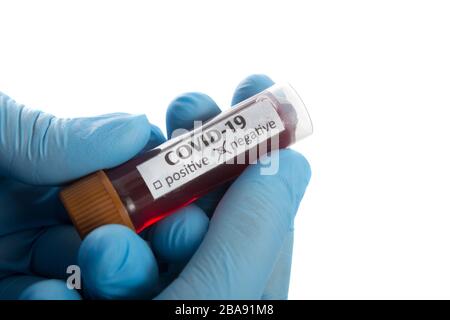Bluttestschlauch in der Arzthand mit blauen medizinischen Handschuhen. Stockfoto