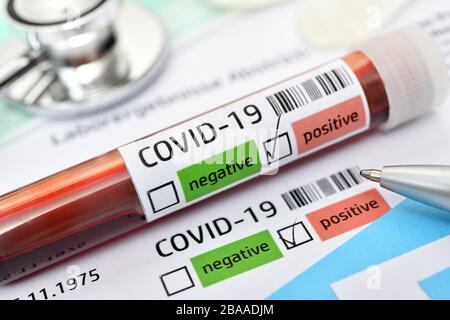 Bluttest mit positiven Ergebnissen von Covid 19, symbolisches Foto Coronavirus, Blutprobe mit positivem Covid-19-Befund, Symbolfoto Coronavirus Stockfoto