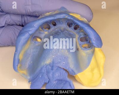 Kiefer und Zähne können in einem Zahnlabor zur Herstellung von Zahnersatz oder falschen Zähnen eingesetzt werden Stockfoto