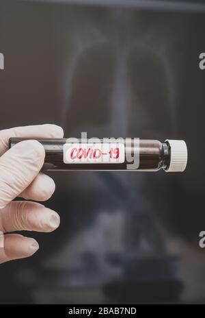 Hand in Handschuh hält Kolben mit der Aufschrift Coronavirus. Röntgenfilm auf dem Brustkorb im Hintergrund. Stockfoto