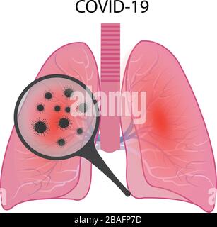 Lunge mit Coronavirus-Infektion COVID19 Stock Vektor