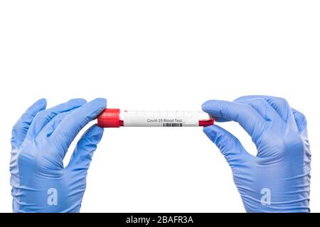 Gerillte Hände der Krankenschwester oder des Virologen, die Kolben mit Blutprobe für den Kovid19-Test isoliert über weißem Hintergrund halten Stockfoto