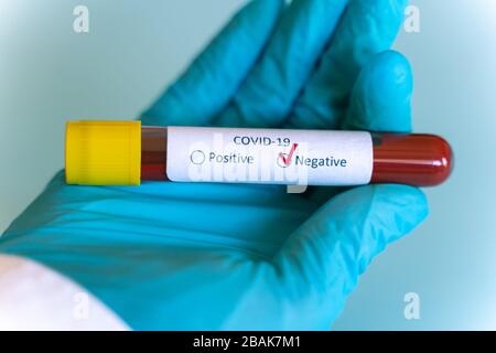 Hand in blauem Handschuh mit Prüfflasche mit Blutprobe von Coronavirus (Covid-19), Blutprobe Coronavirus Covid 19. Negatives Ergebnis Stockfoto