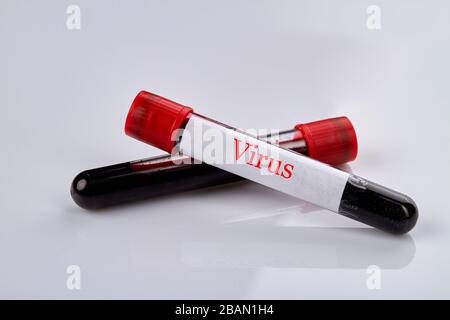 Blutteströhrchen mit Virusproben. Stockfoto