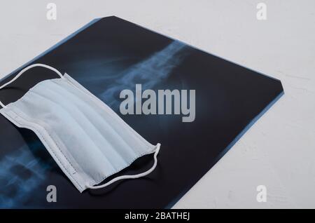 Röntgenaufnahme der Lunge, chirurgische medizinische Maske auf weißem Hintergrund, Pneumonie und Bronchitis Konzept. Virusinfektion. Stockfoto