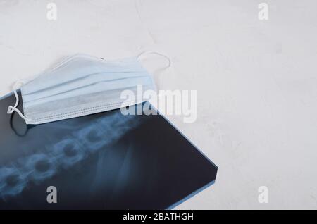 Röntgenaufnahme der Lunge, chirurgische medizinische Maske auf weißem Hintergrund, Pneumonie und Bronchitis Konzept. Virusinfektion. Stockfoto