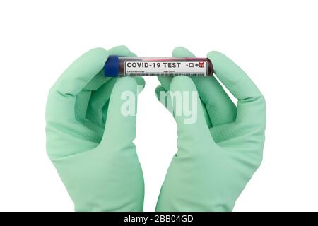 Hände in medizinischen Handschuhen mit positivem Coronavirus Test isoliert auf weiß. Konzept "Growth of Covid-19 Cases" Stockfoto