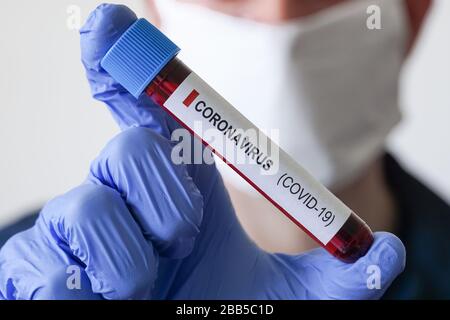 Blutprobe Coronavirus Covid 19, Virus-Bluttest SARS COV 2 Stockfoto