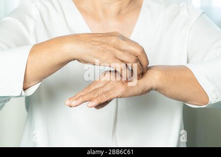 Seniorinnen kratzen das Juckreiz an Ekzemhand, im Gesundheits- und im Medizinkonzept Stockfoto