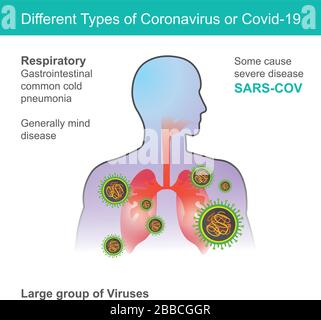 Verschiedene Arten von Coronavirus oder Covid-19. Abbildung Gesundheitswesen und Medizin. Stock Vektor
