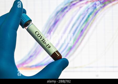 PCR-Nachweis von Coronavirus SARS-COV-2. Blutprobe für die Forschung zu COVID-19. Stockfoto