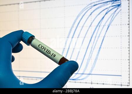 PCR-Nachweis von Coronavirus SARS-COV-2. Blutprobe für die Forschung zu COVID-19. Stockfoto