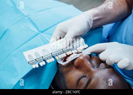 Nahaufnahme des Patienten bekommen Zahnweiß-Behandlung Stockfoto