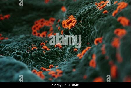 Elektronische Mikroskopie von Coronavirus SARS COVID-19, die menschliche Zellen infiziert, 3D-Illusion auf der Grundlage elektronischer mikroskopischer Fotos Stockfoto