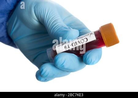 Bluttestschlauch in der Arzthand mit blauen medizinischen Handschuhen. Stockfoto