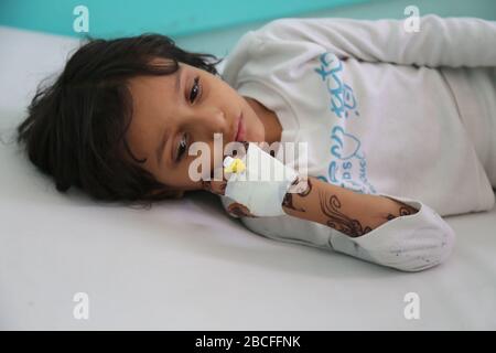 Taiz / Jemen - 29. Juni 2017 : CHOLERA-leidende Kinder in Taiz, Jemen. Stockfoto