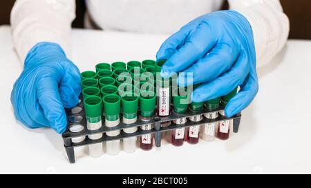 Laborblutprobenröhrchen im Rack. Positive oder negative SARS-COV-2-Ergebnisse. Testzentrum für pandemische Coronavirus-Erkrankungen. COVID-19 Virusinfektion. Stockfoto