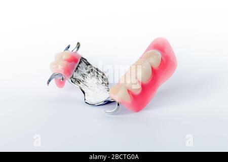 Spangenprothese mit Klammerfixierung auf dem Oberkiefer isoliert auf weißem Hintergrund Stockfoto