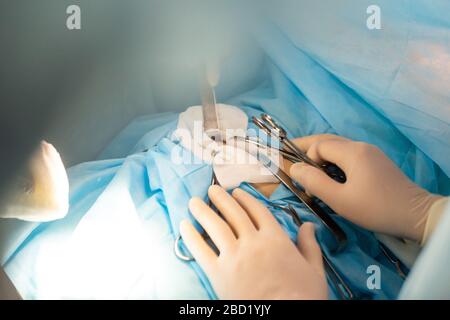 Nahaufnahmen von Arzthandschuhen in medizinischen Handschuhen während der Operation Stockfoto