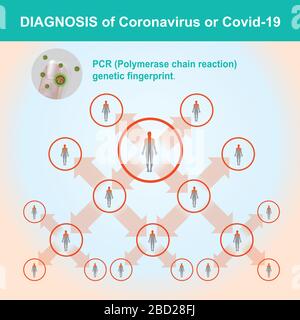 Diagnose von Coronavirus oder COVID-19. Abbildung Gesundheitswesen und Medizin. Stock Vektor