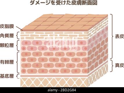 Darstellung der Schicht der beschädigten Haut Stock Vektor