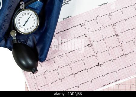 Nahaufnahme von zwei verschiedenen EKG-Testberichten (Ecocardiography Test Reports), die einen abnormalen Herzrhythmus und eine Blutdruckmanschette zeigen Stockfoto