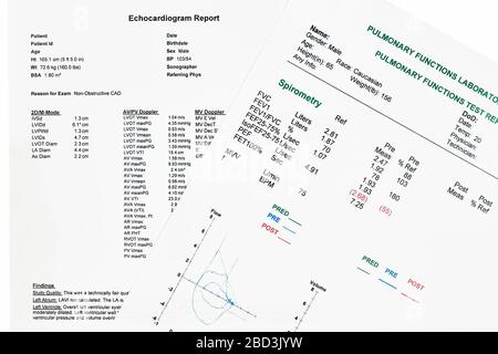 Nahaufnahme des Ecocardiographie-Berichts (EKG) und eines Lungenfunktionstests mit Spirometrie Stockfoto