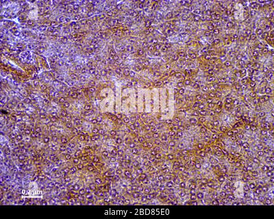 Histologischer Gewebeschnitt der menschlichen Bauchspeicheldrüse, 200-fach Stockfoto