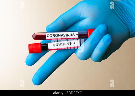 Hand-in-Handschuh hält Röhrchen mit positiver Blutprobe für die Coronavirus Coronavirus Disiase, Stockfoto