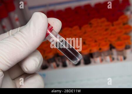 Nahaufnahme einer Blutprobe in der Hand eines Laborarbeiters Stockfoto