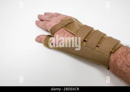 Detail des Mannes, der Handgelenkauflage für zerbrochenen Schaphoidknochen trägt. Stockfoto