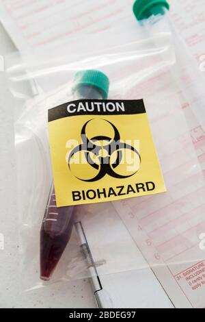 Blutprobe withÂ biohazardÂ Zeichen Stockfoto