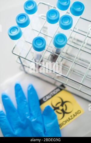 Blutproben withÂ biohazardÂ Zeichen und OP-Handschuh Stockfoto