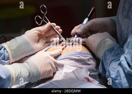 Chirurgen und Krankenschwestern führen eine Magenoperation in einem NHS-Krankenhaus durch. Die NHS steht wegen der Unterfinanzierung durch die Regierung unter Druck. Stockfoto