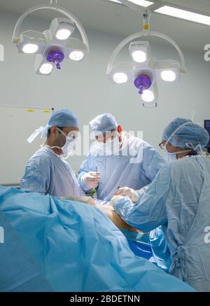 Chirurgen und Krankenschwestern führen eine Magenoperation in einem NHS-Krankenhaus durch. Die NHS steht wegen der Unterfinanzierung durch die Regierung unter Druck. Stockfoto