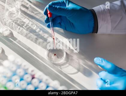 Nahaufnahme. Ein Forscher im Labor arbeitet an einem Impfstoff gegen das Virus. Tropfen Blut in einem Tropf. Stockfoto