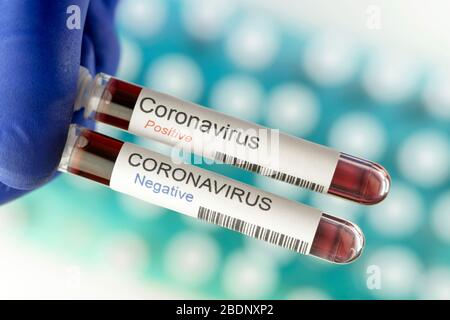 Ein negatives und ein positives Ergebnis von Coronavirus-Tests. Viele Blutproben in speziellen Laborhaltern als Hintergrund. Stockfoto