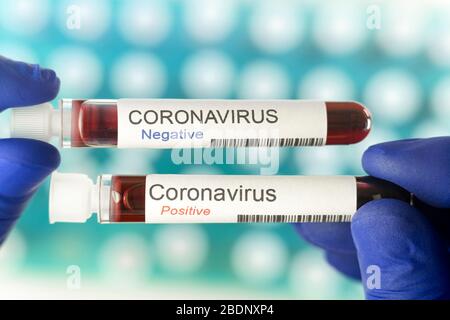 Coronavirus-Tests - ein positiver und ein negativer Halt durch einen Laborarbeiter Stockfoto