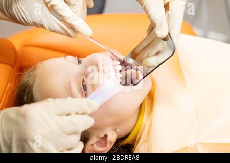 Kieferorthopäde, Zahnkidentheken, Ausrüstung Zähne Cast.Störungen der Zähne, obere Zähne hinter unteren Zähnen.Blauer Zahnabdruck eines Kindes oberen Stockfoto