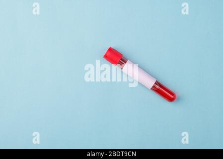 Neuartiges Corornavirus-Testkonzept. Oben oben oben oben Nahaufnahme Foto von Fläschchen mit Blutprobe und Etikett auf sie isoliert über blauen Hintergrund Stockfoto