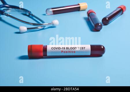 Coronavirus Teströhrchen, Schnellbluttest auf Coronavirus oder Covid-19 Pandemie Stockfoto