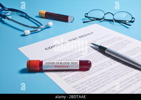 Coronavirus Teströhrchen, Schnellbluttest auf Coronavirus oder Covid-19 Pandemie Stockfoto
