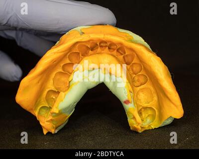 Zahnform aus den oberen Backen aus Silikonmaterial. Der Abdruck der Zahnreihe von hoher Präzision. Stockfoto