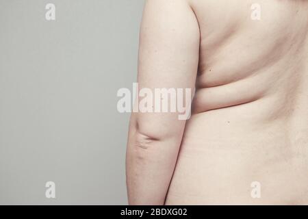Übergewicht, Fett Körper Konzept. Die Wirkung von Insulin auf den menschlichen Körper. Ernährung Stockfoto