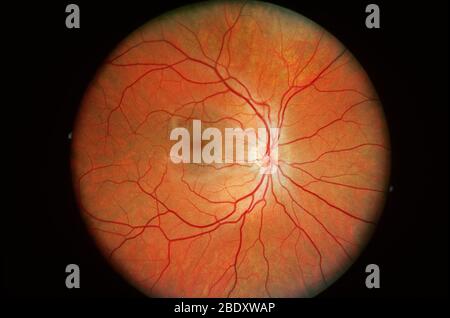 Normale Retina Stockfoto