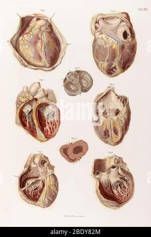 Herz, Hohlräume und Ventile, Abbildung, 1878 Stockfoto