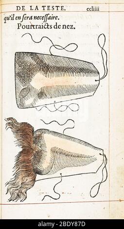 Prothetik Nasen, Ambroise Pare, 1561 Stockfoto